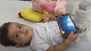 Toddler refuses to get treated for fractured legs, doctors then plaster her doll to convince her.