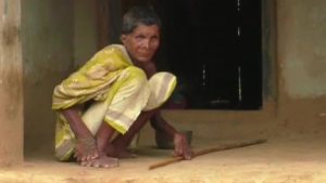 Odisha: Woman born with 20 toes, 12 fingers, branded a witch, forced to stay indoors.