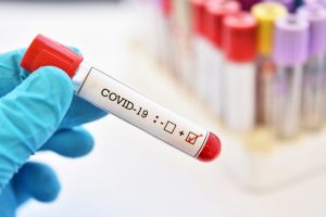 Palghar mob lynching accused tests positive for coronavirus COVID-19