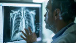 Delhi News: दिल्ली में TB का खतरा बढ़ा, 40% आबादी इन्फेक्टेड; अस्पताल बेड और एम्बुलेंस बढ़ाने की तैयारी