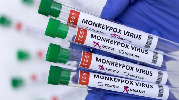 Can monkeypox outbreak, which represents a global health emergency, be stopped? Here's what WHO thinks