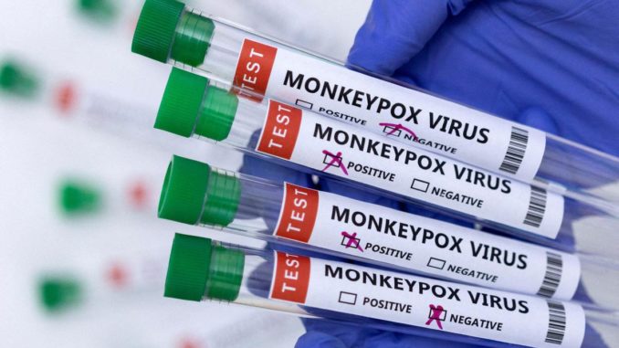 Two monkeypox cases confirmed - Is India staring at a Monkeypox outbreak?