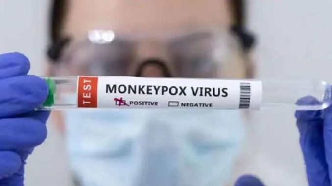 Monkeypox now in Uttar Pradesh? Suspected case found in this district, samples sent for testing