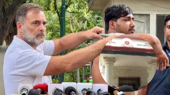 पैलेट गन से घायल छात्र को लेकर पुलिस स्टेशन पहुंचे राहुल गांधी, FIR दर्ज होने तक थाने में रहने का ऐलान